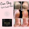 Feet Cra.ck Heel Repair Cream Smooth Foot C.rack Cra.cked Heel Repair Foot Cream (Pack Of 1 Jar 50 GM) view 2