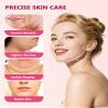 V-Line Lifting Collagen Face Mask, Deep Collagen Face Mask for Women, 5 Pcs view 4
