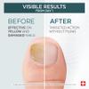 PODERM Tea Tree Nail Serum - 6 ml | 4-in-1 Formula for Damaged, Yellowed, and Dull Nails Helps Even Nail Thickness Swiss Made view 3