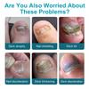Tolnaftate 1% Nail Solution, Ingrown Toenail Treatment Extra Strength for Repairing Thick, Damaged, Discolored Nail & Ingrown Toenail - 30ml view 3