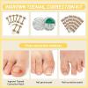 Ingrown Toenail Treatment Toolkit,Professional Ingrown Toenail Removal Kit, Ingrown Toenail Corrector Set,with Breathable Ingrown Toenail Strips,Curved Toenail Corrector Patch,Painless File and Lifter view 3