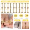 Ingrown Toenail Treatment Toolkit,Professional Ingrown Toenail Removal Kit, Ingrown Toenail Corrector Set,with Breathable Ingrown Toenail Strips,Curved Toenail Corrector Patch,Painless File and Lifter view 4