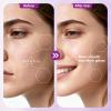 Smooth Dermaplane Razor for Women Facial Peach Fuzz Remove - Facial Hair Removal Kit with 12 Blades, 3 Speeds & LED Light view 2