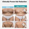 3-in-1 Electric Body Hair Trimmer, White, Ceramic Blades, Wet and Dry Use, USB Rechargeable, Double-Headed Shaver with Nose Ear Trimmer view 4