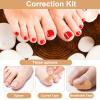 176pcs Ingrown Toenail Set, Include Breathable In-Growing Toenail Strips Curved Toes Patches Lifting Pedicure Tools & Pads Suitable for Home Pedicure view 3