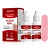 SOVS Fungi Nail Toenail Treatment,Gentle Formula, Effectively Improves Nails for a More Beautiful Appearance (2Pcs, 1 oz) view 1
