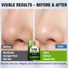Shaeva Natural Charcoal Pore Strips, Blackhead Remover Strip, for Oily Skin, Strawberry Nose, Deep Clean & Shrinking Pores & Smoothing Skin (10 pcs) view 2