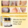 Bee Venom Toenail Treatment Extra Strength, Nail Treatment with 25% Undecylenic Acid, Nail Repair with Tea Tree Oil for Yellow, Thick, Damaged, Discolored Toe Nail & Fingernails-Y03 view 3