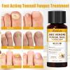 Bee Venom Toenail Treatment Extra Strength, Nail Treatment with 25% Undecylenic Acid, Nail Repair with Tea Tree Oil for Yellow, Thick, Damaged, Discolored Toe Nail & Fingernails-Y03 view 4