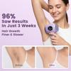 Ufree IPL Hair Removal Device, Full Body for Women Men at Home, Long-Lasting & Painless, 20J & 3 Smart Modes, 990k Flashes, Hair Remover for Armpits Legs Arms Face Bikini Line (Purple) view 3