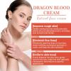 2PCS Dragons Blood Cream, Retinol Dragon Blood Cream, Royal Retinol Creams for Smooth Skin, Nourishing, Moisturizing, Firming Cream for All Skin Types view 2