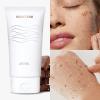 MSMEESHU [2 Pack] Gentle Exfoliating Gel for Face & Body - 150g/5.29oz Facial Peeling Gel - Visible Dead Skin Remover & Pore Deep Cleansing Scrub - Brightening Skincare for All Skin view 2