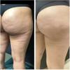 Cheek Chic Cellulite Gel view 2