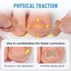 Ingrown Toenail Treatment Kit - Breathable Corrector Strips Painless Pedicure Tools for Men Women view 2