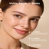 Red Light Therapy Mask for Face and Neck Medical Grade FDA Approved view 3