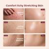 Momcozy Pro-Collagen Stretch Mark Cream - Belly Firming Moisturizer 5.29 oz view 2