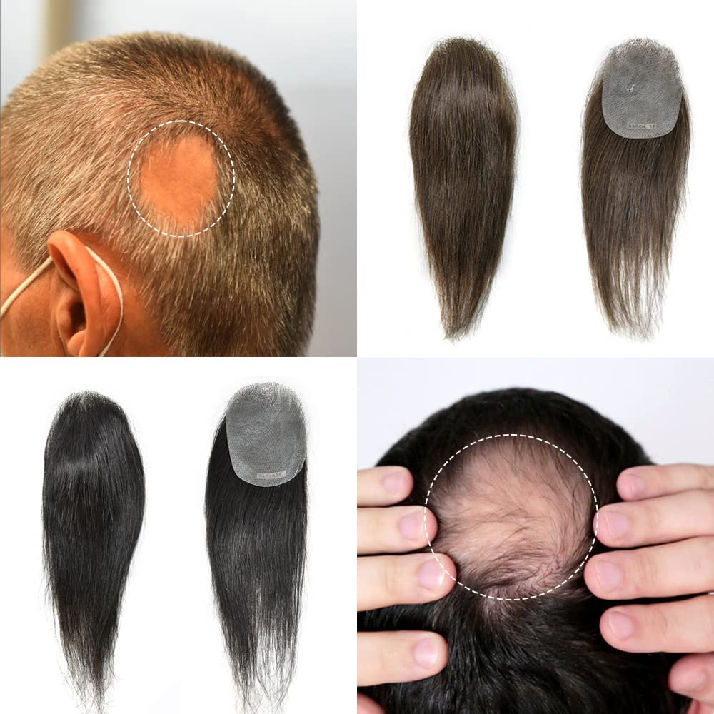 Right Hair Thin Skin Hair Patch Toupee For Men Bald Spot V-Looped Hair Replacement System For Bald Spot Transparent Mens Hair Piece (#1B OFF BLACK-100% Light Medium Density, 6cm X 8cm-14'')