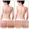 3PCS Exfoliating Mitt for Body Exfoliating Gloves for Shower Body Scrub Glove Exfoliating-Body Scrubbe for Bath Shower Spa Massage and Body-Scrubs Dead Skin Women Men view 4