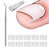 (50+1) Pcs Ingrown Toenail Corrector Treatment Set, Professional Ingrown Toenail Removal Kit with Toenail Lifter, Easy Fixed Ingrown Toenail Tool, Toenail Straightener Strip for Foot Care Repair view 1