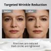CalmSphere Premium Eye Serum with 360 Roller, Reduce Puffiness, Fade Dark Circles, Anti-Wrinkle, 15ML/0.51FL.OZ view 4