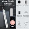 Visual Blackhead Remover with 50x Camera for Phone, Manual Pimple Popper Tool with LED Light, USB C Rechargeable Comedone Extractor for Face and Nose (Black) view 2