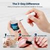 3 Days Nail Care Oil, 2026 New 3 Days Nail Care Oil with Keratin, Moisturizing Strengthening Nail Care Polish Oil for Dry, Weak, Fragile Nails (1 PCS) view 4