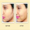 FO Ponnatharam Hartal Warki Stone | for Hair Removal 1.76Ounce (50Gram) view 4