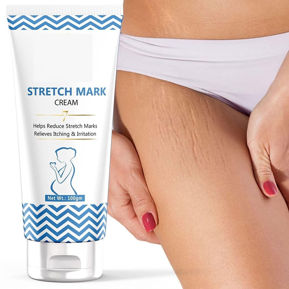 FO Stretch Marks Cream for Reduce Stretch Marks & Scars During Pregnancy - Women (100 g), 3.53 Ounce