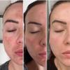 TCARevive Care 70% Professional Exfoliating Skin Resurfacing Peel Improves Texture, Tone & Appearance Cosmetic Use Only 1.0 fl oz. e, 30 mL view 3