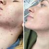 TCARevive Care 70% Professional Exfoliating Skin Resurfacing Peel Improves Texture, Tone & Appearance Cosmetic Use Only 1.0 fl oz. e, 30 mL view 4