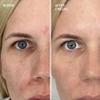 Dr. Brandt Advanced Pore Cleansing Duo - Includes Pores No More Purifying Cleanser (4.2 fl oz) + Advanced Microdermabrasion Face Exfoliator Travel Size (0.7 oz) view 2