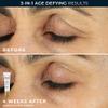 RoC Clinical Mini Retinol Anti-Aging Skincare Routine Kit with Line Smoothing Eye Cream, Serum Capsules, and Max Hydration Face Cream for Wrinkles and Dark Circles view 4