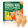 Fungal Nail Patches 21 PCS, Toenail Fungus Treatment Extra Strength, Hydrogel Nail Repair Patches for Overnight Use, Helps Improve Appearance of Damaged and Discolored Nails, Non-Slip (21P) view 1
