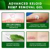Advanced Keloid Bump Removal Gel (3 Packs): Silicone Keloid Scar Removal Cream for Scars from Piercing, Surgical Marks, Acne, and Burns, Keloid Treatment for Ears, Face, and Body with Healing Formula view 4