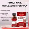 Fungi Nail ToenailTreatment,Gentle Formula,Effectively lmproves Nails for a More Beautiful Appearance(30ml*2) view 2