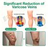 Vein Target Microdarts Patch, 2026 New Leg Varicose Veins Patchs, Vein Target Patch, Relieves Leg Discomfort, Moisturizes And Smooths Skin. (2PCS) view 3