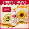 Stretch Mark Lotion for Pregnancy Massages Body & Reduces Scar Appearance, Removes Stretch Mark Prevention, Prenatal & Postnatal Tummy Skin Care, Firming Skin Elasticity for Maternity (10.1 Fl Oz) view 2