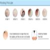 Facial Vein Treatment Device, Red Blood Removal Device, Easy Treatment, 4 Levels Intensity Adjustable, 0.03mm Needle Wire, Minimally Invasive and Painless, Safe and Reliable, for Home Beauty view 4