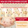 Stretch Mark Oil for Pregnancy Massages Body & Reduces Scar Appearance, Removes Stretch Mark Prevention, Prenatal & Postnatal Tummy Skin Care, Firming Skin Elasticity for Maternity, 2.03oz(1Pack) view 3