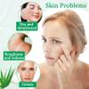 WENJLYJ 3PCS Organic Aloe Vera Gel,Aloe Vera Soothing Gel,Natural Moisturizing Lotion for Soothing Skin Care,Long Lasting Moisturizing body Lotion,After Sun Skin Care Cream for Face and Skin view 4