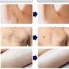 808nm Hair Removal With Cooling Technology For Full Body Ideal for Spas & Home Gyms, White view 3