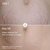 Belly Firming Cream for Women, Skin Tightening and Moisturizing Treatment with Shea Butter and Bentonite Clay, Smooths Stretch Marks, Postpartum Body Care, 3.4 Fl Oz view 4