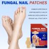 Fungal Nail Patches 42 PCS,Nail Repair Patches Extra Strength Hydrogel,Nail Fungus Patches Overnight Treatment for Damaged Nails,Restore Discoloration&Thickness, Safe for Sensitive Skin,Easy to Apply view 3