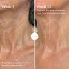 Riversol Neck Cream for Women Over 50 | Tightening, Firming & Turkey Neck Treatment | Reduces Sagging, Wrinkles & Crepey Skin | Retinol + Peptides | Sensitive Skin Safe | Dermatologist Developed view 3