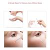 Balacoo Facial Blackhead Extraction Tool Set 5pcs with Mirror, Removal Kit for Sebaceous Blemish and Pimple Cleansing, Tool for Face and Nose view 4