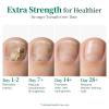 Apuree Extra Strength Antifungal Pen 25% Undecylenic Acid 1% Tolnaftate view 4