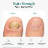 APUREE 45 Pcs Fungal Nail Patches, Toenail Fungus Patches Extra Strength view 2