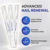 Toenail Fungus Pen Extra Strength: Nail Treatment with 25% Undecylenic Acid & Tea Tree Oil - Repairs Yellow Thick Brittle Toe and Fingernails - 3 Pens with 5 Nail Files view 3