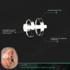 EARPRESS Keloid Pressure Clips for Ear Adjustable Compression Clips, Comfortable Pressure Support for Keloid | Circle 1.5 - Clear view 3