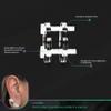 EARPRESS Keloid Pressure Clips for Ear Adjustable Compression Clips, Comfortable Pressure Support for Keloid | Circle 2.3 - Clear view 3